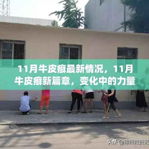 11月牛皮癣最新动态，变化中的力量与自我成就之路