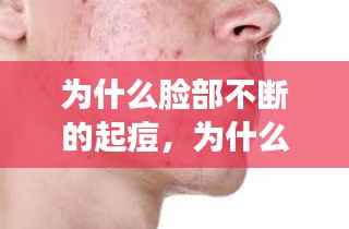 为什么脸部不断的起痘,为什么脸上不停的长痘痘