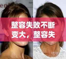 整容失败不断变大,整容失败了后悔的要死