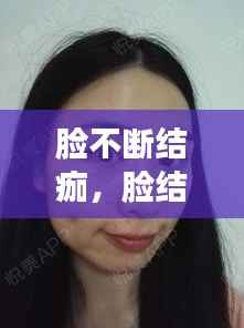 脸不断结痂,脸结痂不掉怎么办