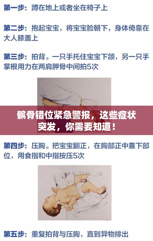 髌骨错位紧急警报,这些症状突发,你需要知道!